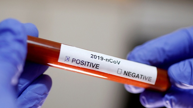 Elevan a 361 cifra de muertos por coronavirus en China