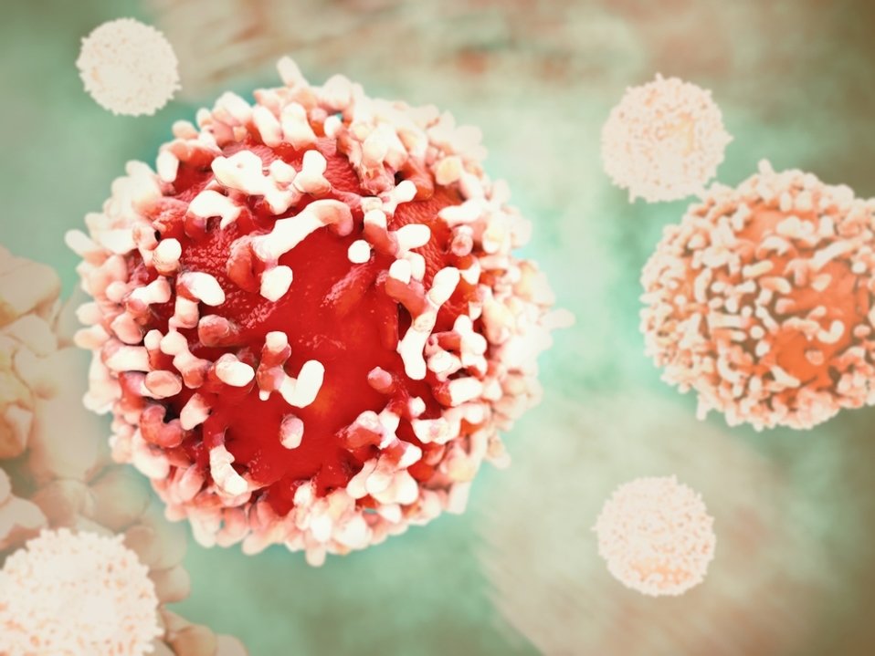 El nuevo estudio permitiría tratamientos personalizados contra el cáncer. (Shutterstock)