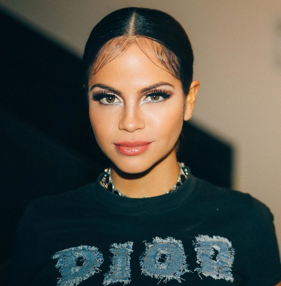 Natti Natasha aparece con golpe en la cara y canta Me estás matando  (Instagram).
