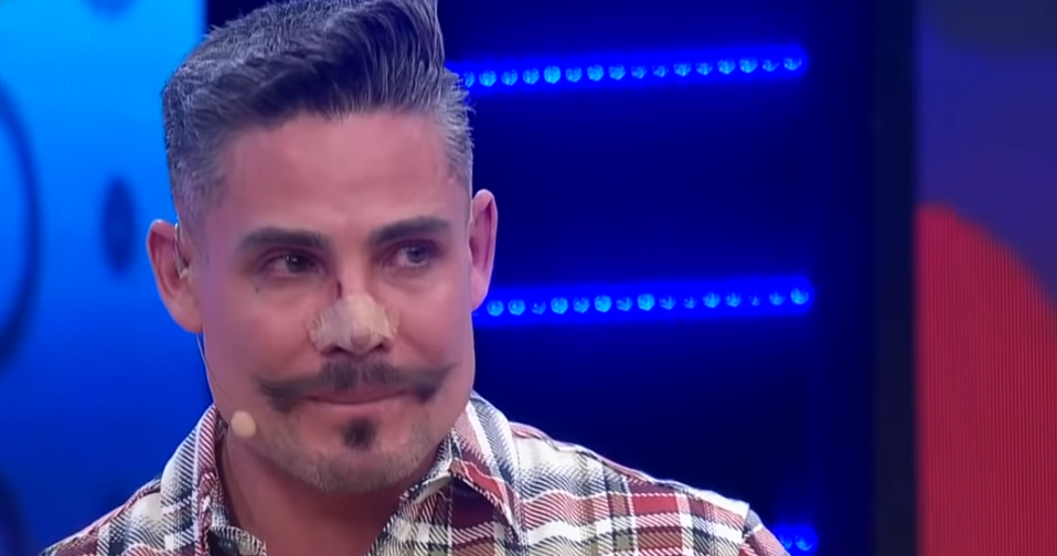Adrián Cué relató que tiene un polímero en la nariz.(Especial)