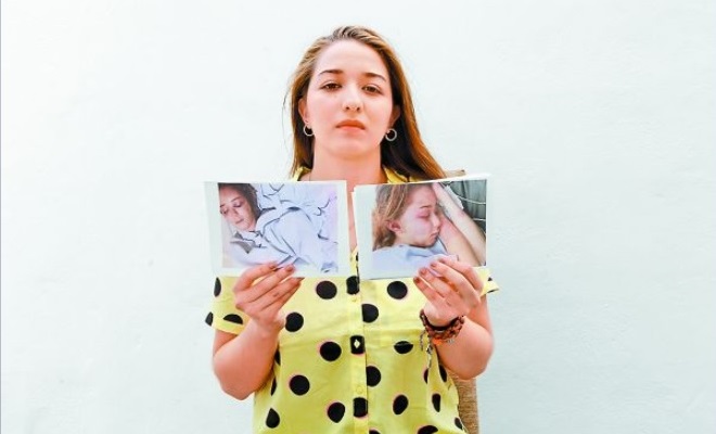 La estudiante recibió golpes severos calificados solo como lesiones y violencia familiar. (Nelly Salas)