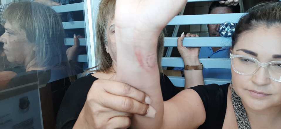 Una diputada resultó con varias mordidas. (Margarita Rojas)