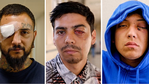 "It’s Mutilation’: The Police in Chile Are Blinding Protesters" (Especial).