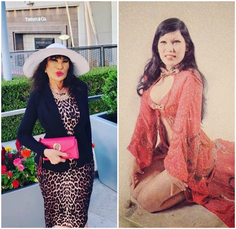 Antes y después de Lyn May. (Instagram)