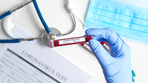 Prueba de coronavirus. |Shutterstock
