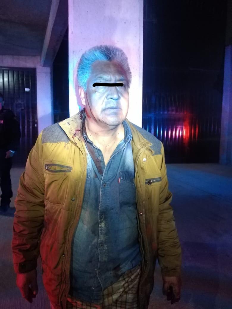 El sujeto fue puesto a disposición de la FGJEM.