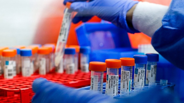 CdMx aplicará el doble de test para covid-19
