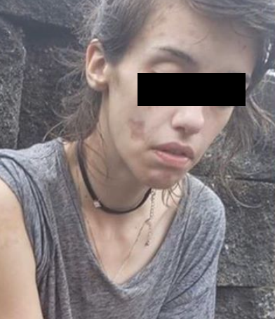 Joven que superó su adicción a las drogas mostró su transformación. (Facebook)