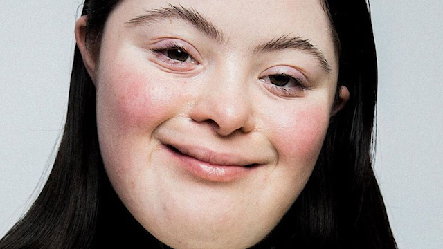 Ellie Goldstein, la modelo con síndrome de Down que es el nuevo rostro de Gucci