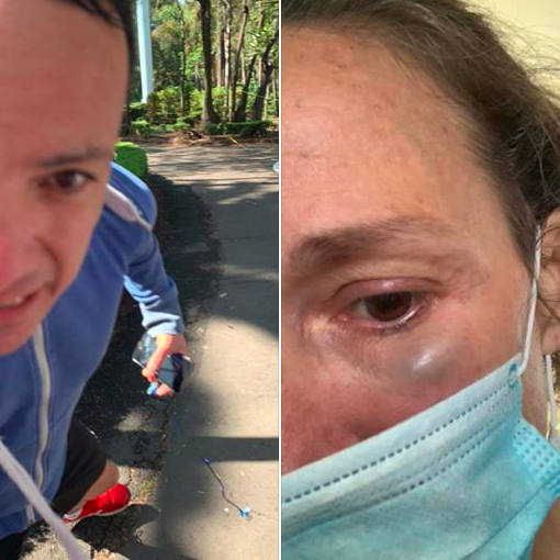 En el Parque Hundido, una mujer fue agredida por un hombre mientras corría. (Facebook)