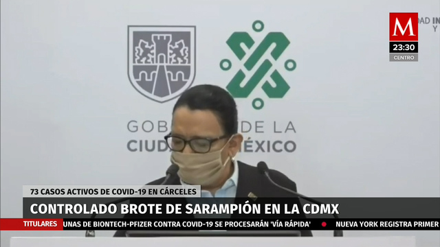 Brote de sarampión en CdMx ya está controlado, informa Secretaría de Salud