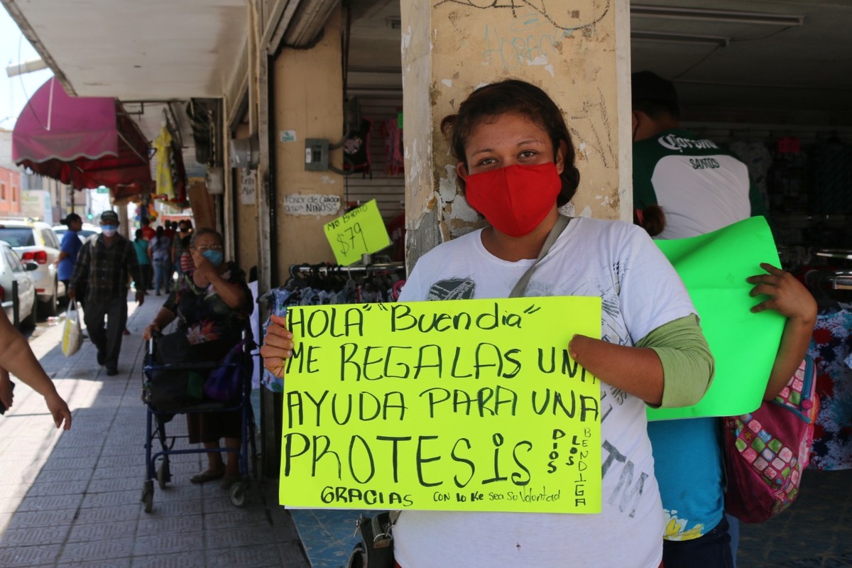 La joven mujer nació con una malformación genética. (Armando Moreno)