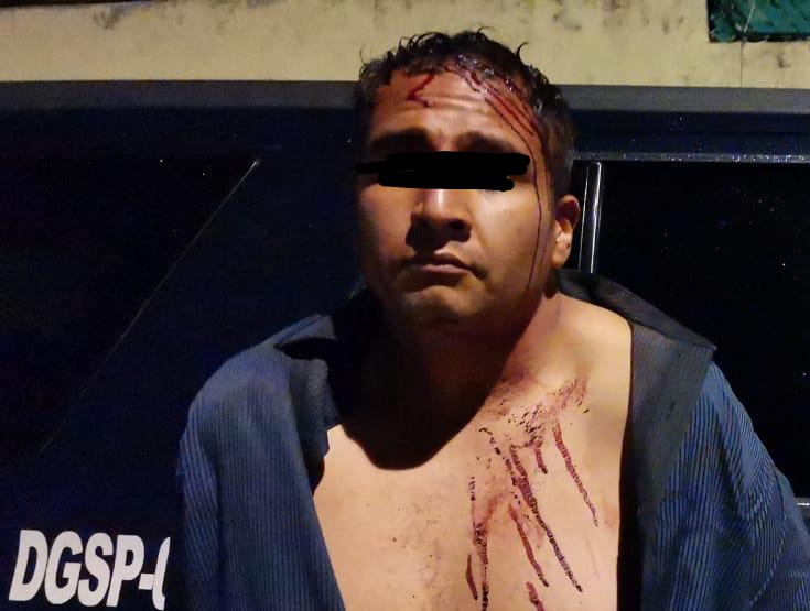 La víctima se resistió al asalto y se enfrentaron a golpes.