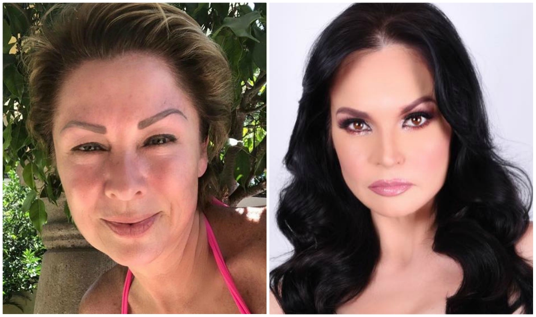 Ana Patricia mencionó que su mejilla le dolía mucho después de recibir la cachetada (Instagram).