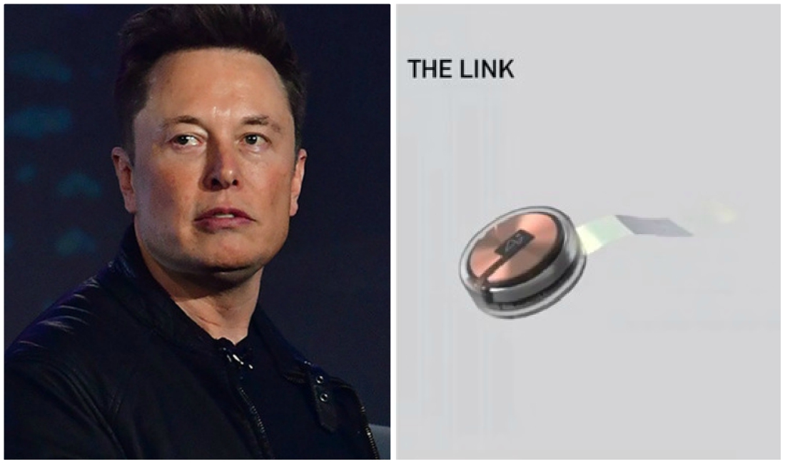 Elon Musk mencionó que el chip podría ayudar a personas con problemas de memoria (Instagram).