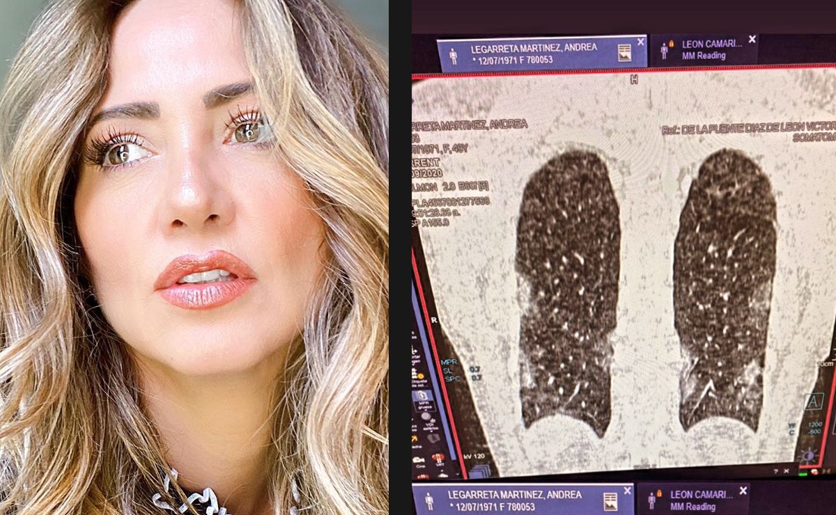 Andrea Legarreta cuenta cómo están sus pulmones; deja el hospital. (Instagram)
