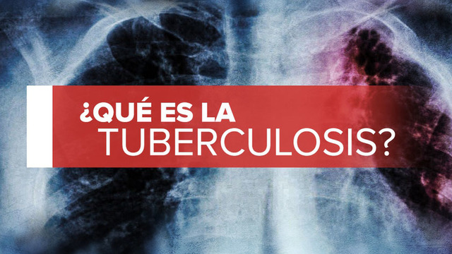 ¿Qué es la tuberculosis, cuáles son los síntomas y cómo es el tratamiento?