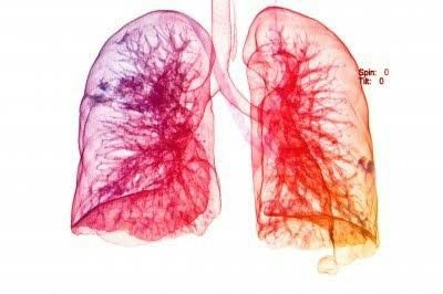Estas condiciones afectan adversamente el sistema respiratorio.