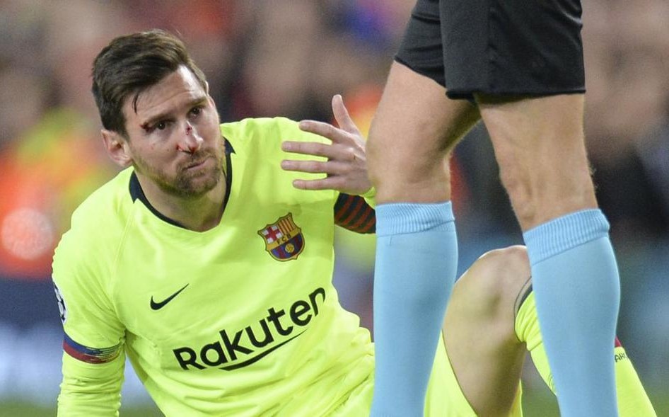 Lionel Messi tras sufrir un golpe en Champions League (AP)