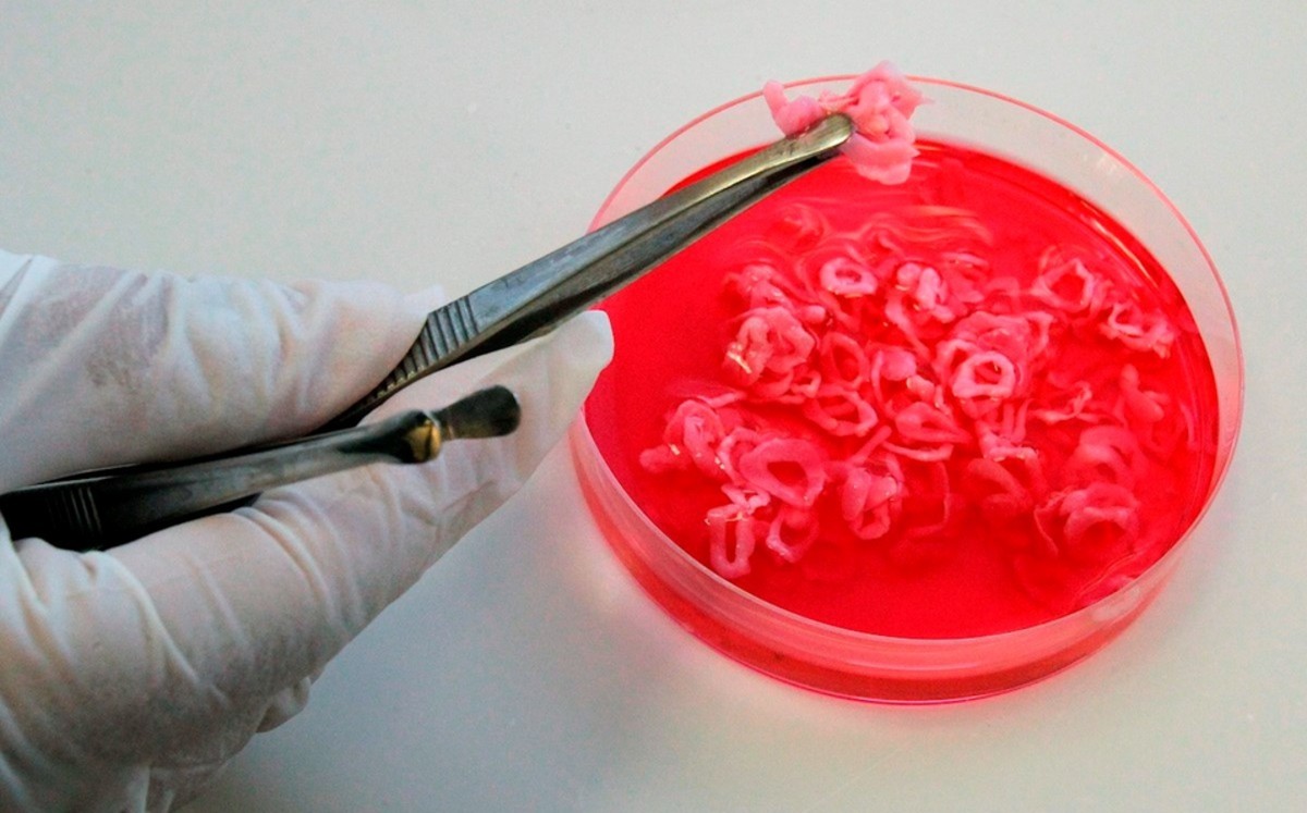 Wuhan detecta rastros de coronavirus en carne congelada importada de Brasil