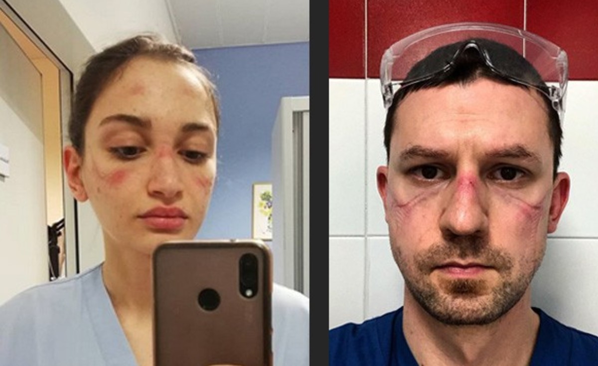 Caras de trabajadores de la Salud, las más afectadas (foto cortesía)