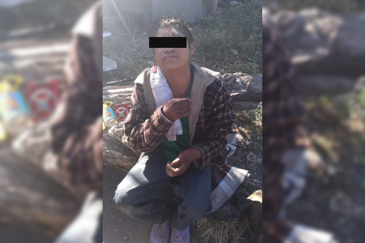 La víctima presentaba diversos golpes y una herida sangrante en la cabeza de tres centímetros. (Especial)