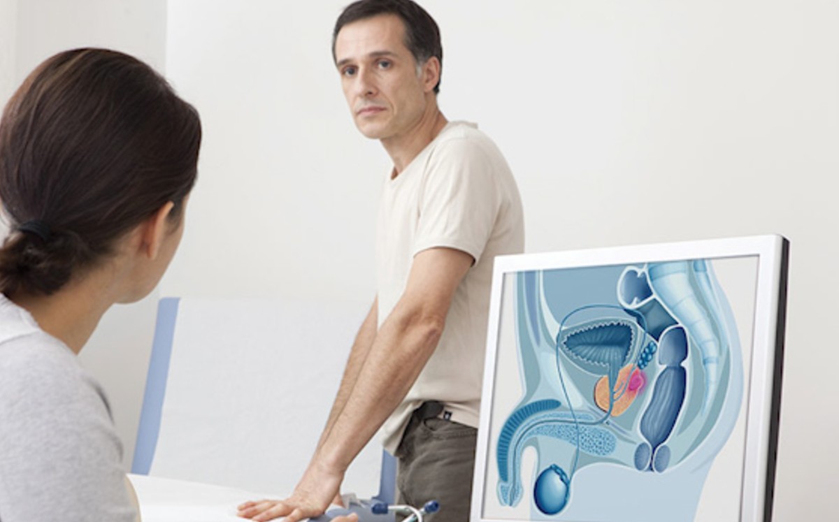¿Cómo prevenir y detectar el cáncer de próstata?