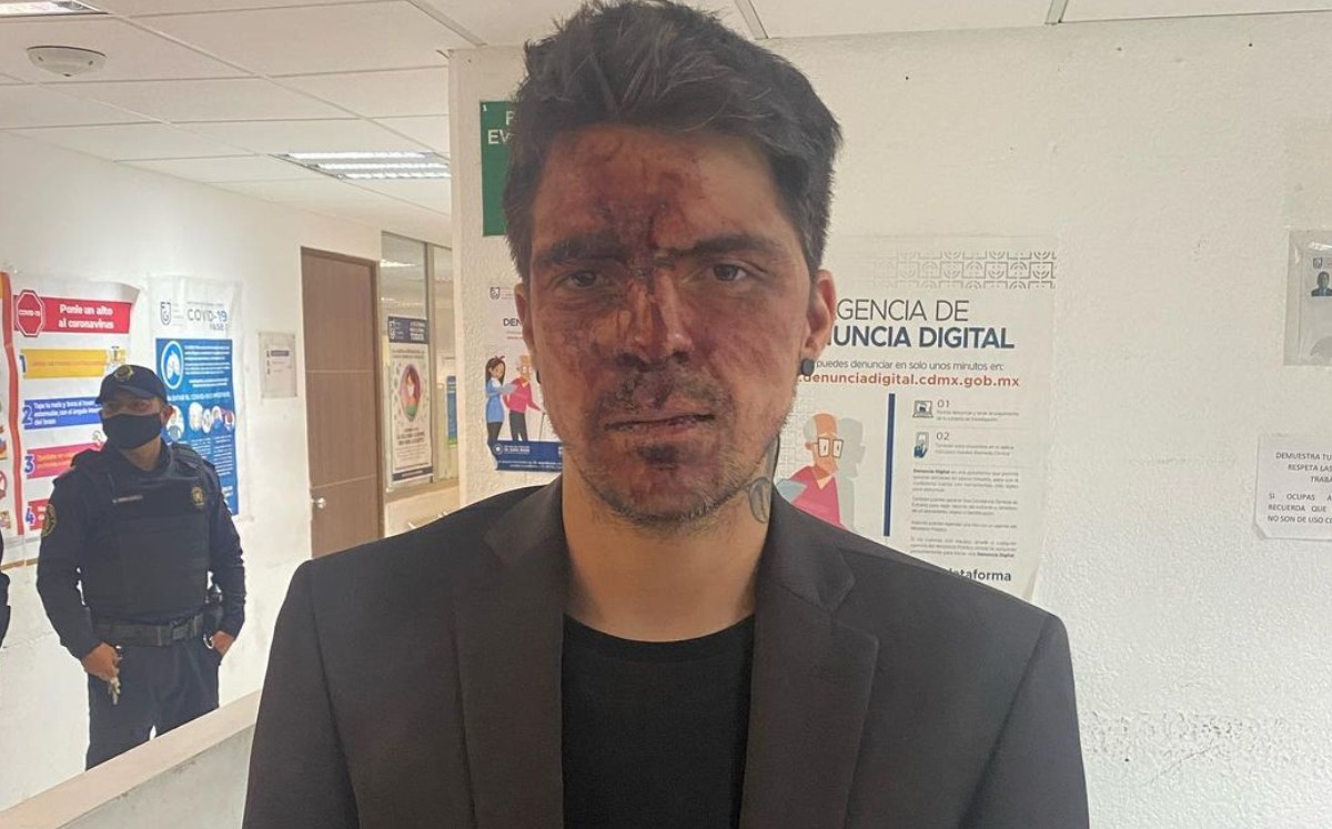 César D'Alessio, hijo de Lupita D'Alessio fue víctima de Arturo Montiel: lo golpeó. (Instagram)
