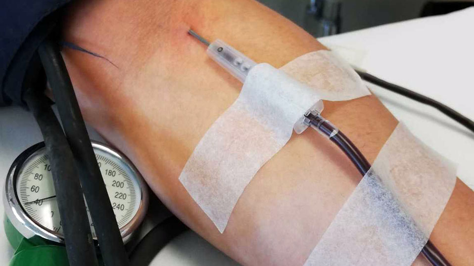 Suero equino hiperinmune, útil para generar anticuerpos al SARS-CoV-2