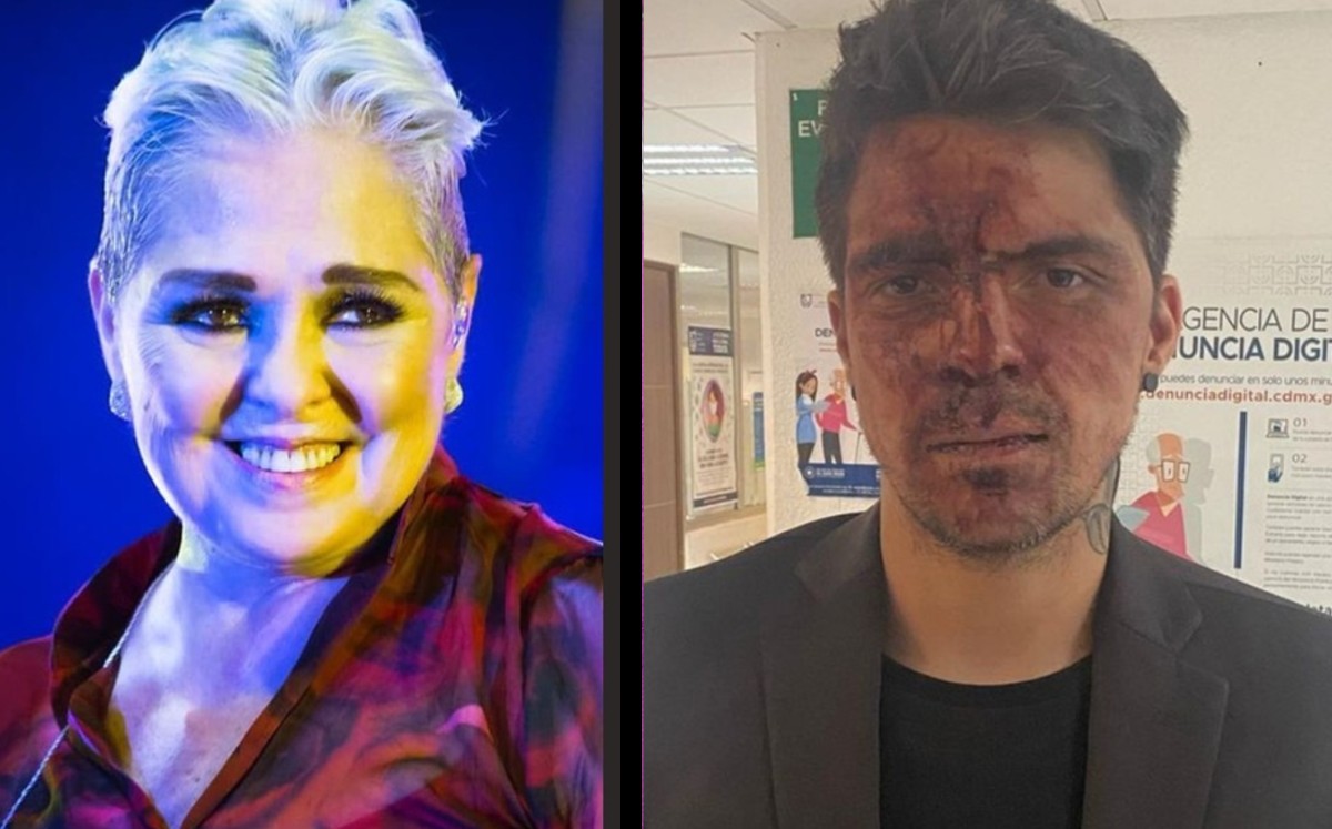 Lupita D'Alessio revela que su hijo se sometió a una cirugía de reconstrucción facial tras agresión. (Instagram)