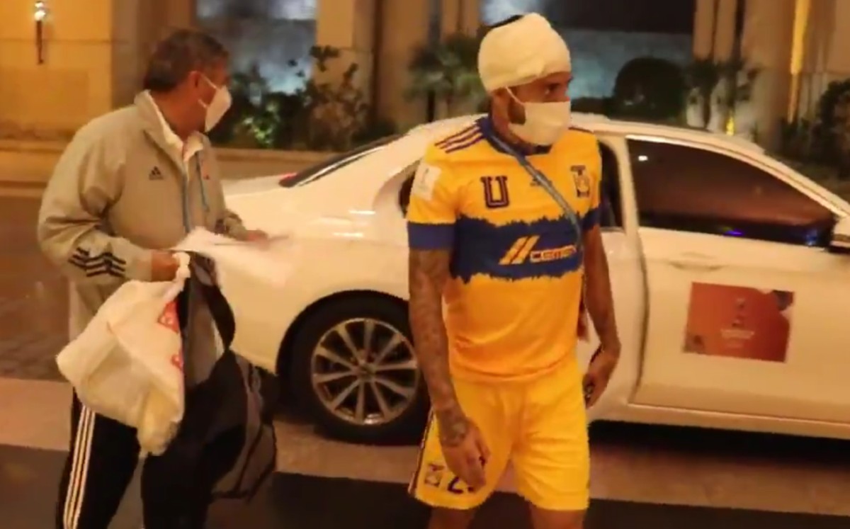 Javier Aquino, tras el golpe en la cabeza en el Mundial de Clubes (Especial)