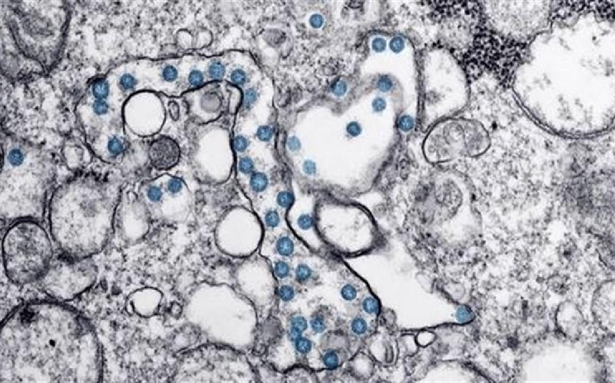 Investigadores señalan que nuevos brotes de coronavirus podrían surgir de la coinfección de dos cepas en animales. (EFE)