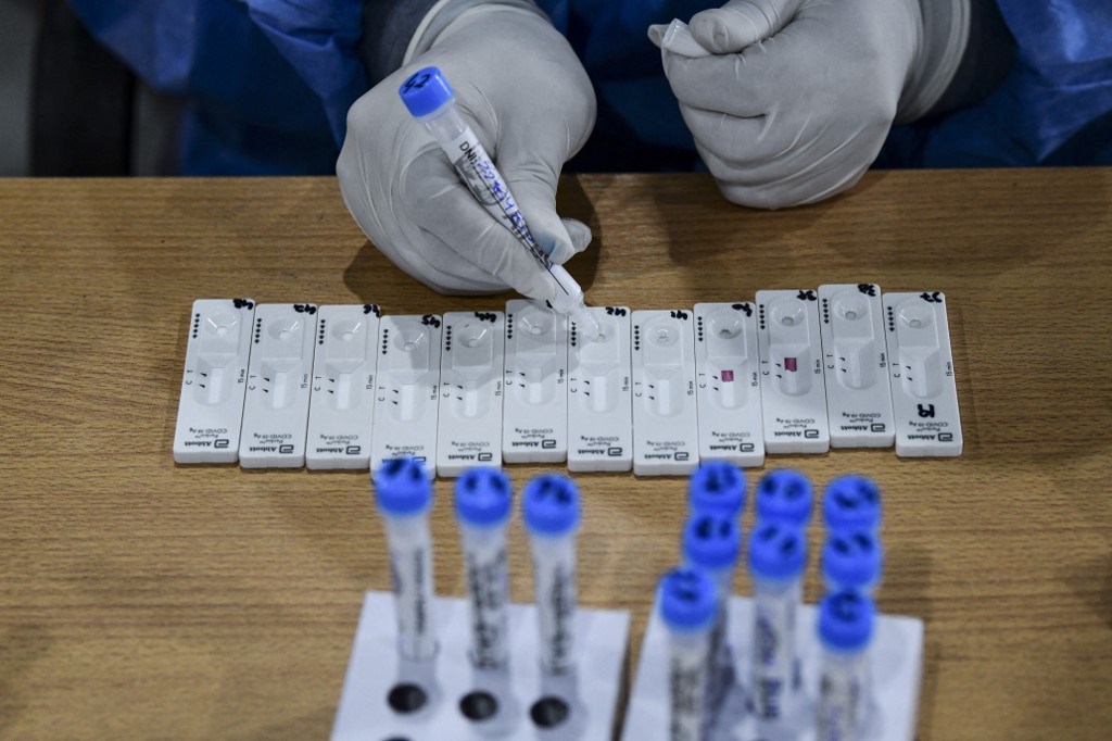 Las pruebas de antígenos son las más baratas y dan un resultado en menos de 20 minutos. (AFP)