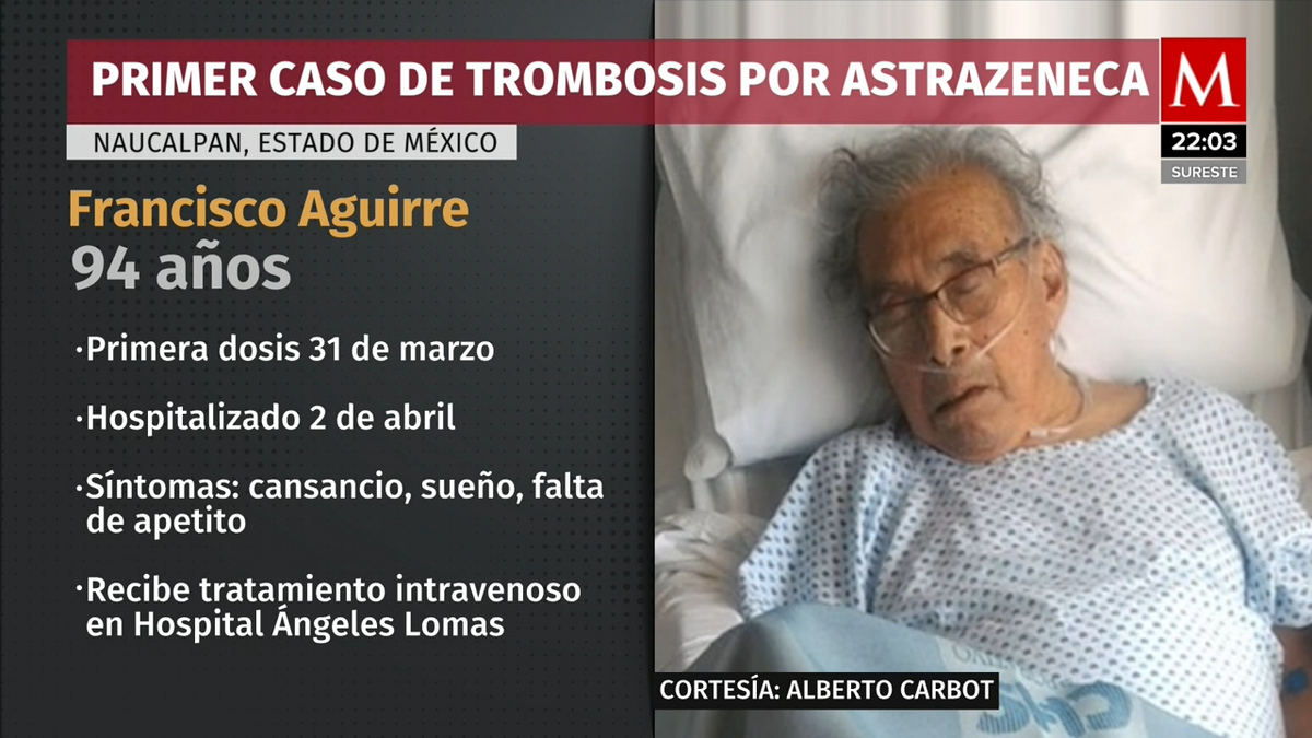 Se registró el primer caso de trombosis relacionado a la vacuna de Astra Zeneca en México
