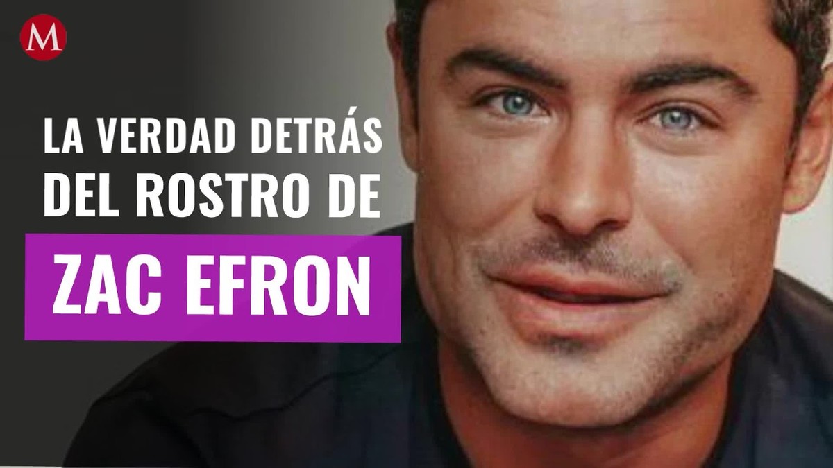 ¿Cirugía plástica? Locutor revela la verdad detrás del rostro de Zac Efron: "Un Picasso"