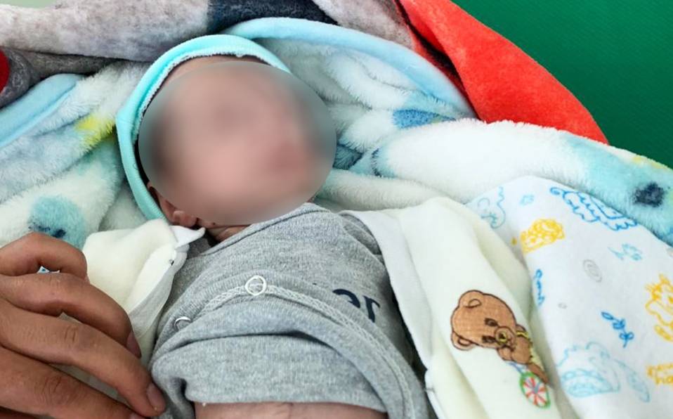 En IMSS de Irapuato salvan vida de bebé con intestinos expuestos