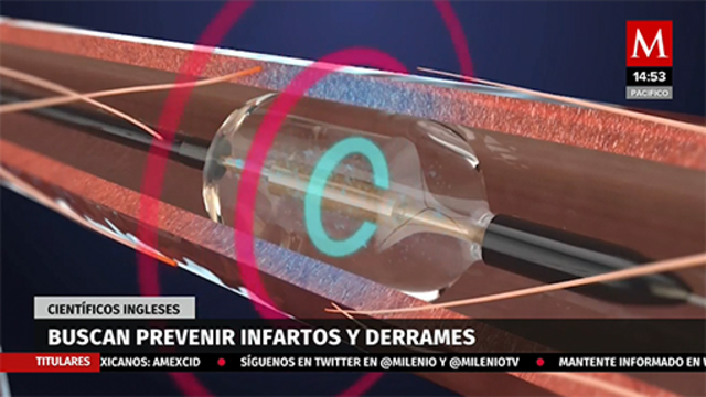 Científicos ingleses buscan prevenir infartos y derrames usando ondas de música