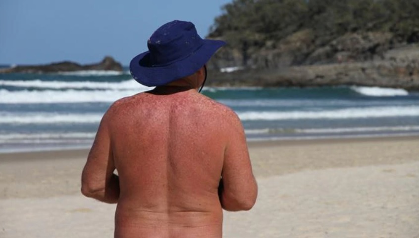 La pareja de nudistas había irrumpido las medidas de aislamiento por el coronavirus. | Foto publicada por abc.net.au