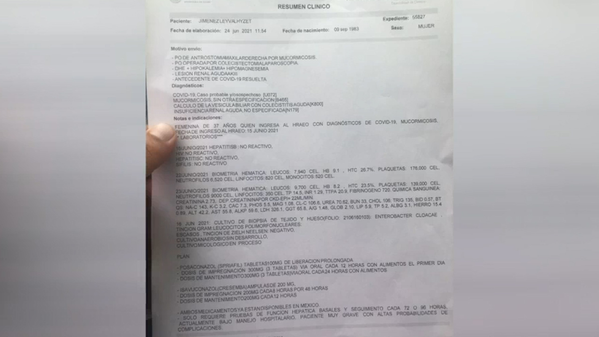 Otro paciente grave por hongo negro en Oaxaca