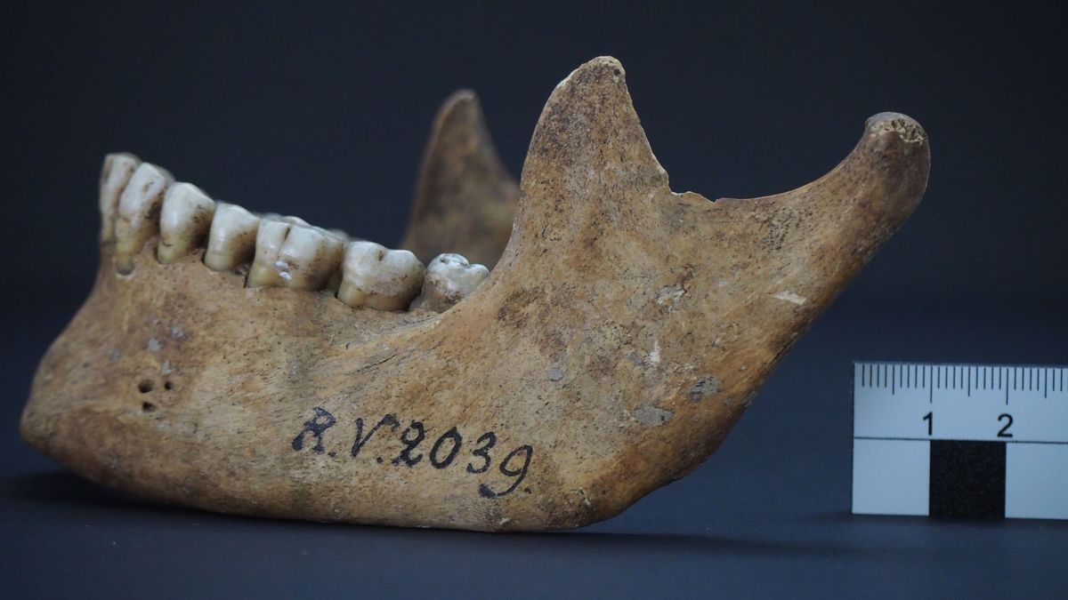La bactería Yersinia pestis fue la causante de la pandemia contra covid-19 | Especial