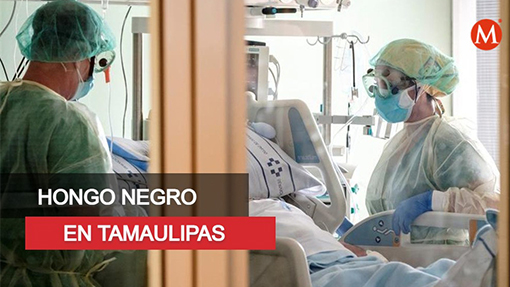 Secretaría de salud de Tamaulipas descarta caso de hongo negro