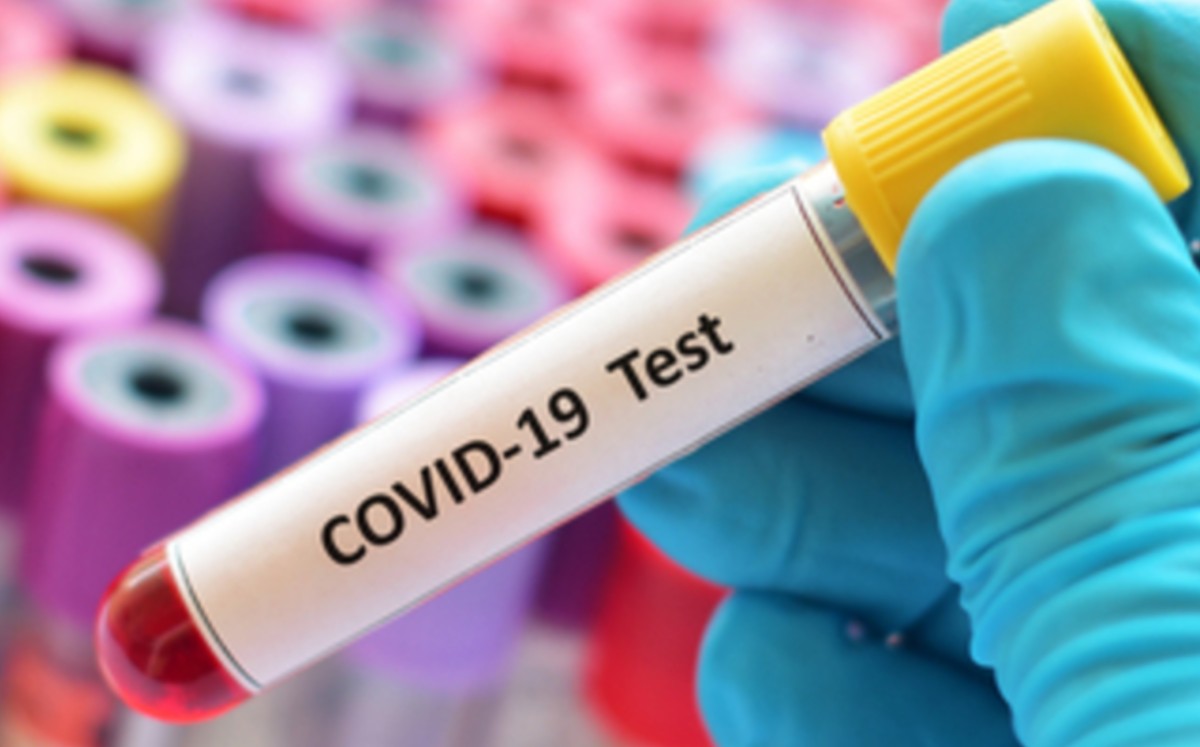 ¿Podría contagiarme de covid-19? Estudio asegura que mediante la sangre podemos saberlo. (Especial)