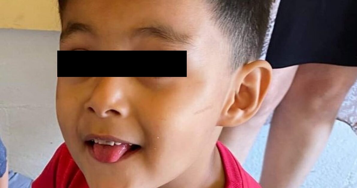 El pequeño Abiel Valenzuela Zapata fue atendido en la clínica de odontología pediátrica Tiny Teeth. | Archivo de su familia