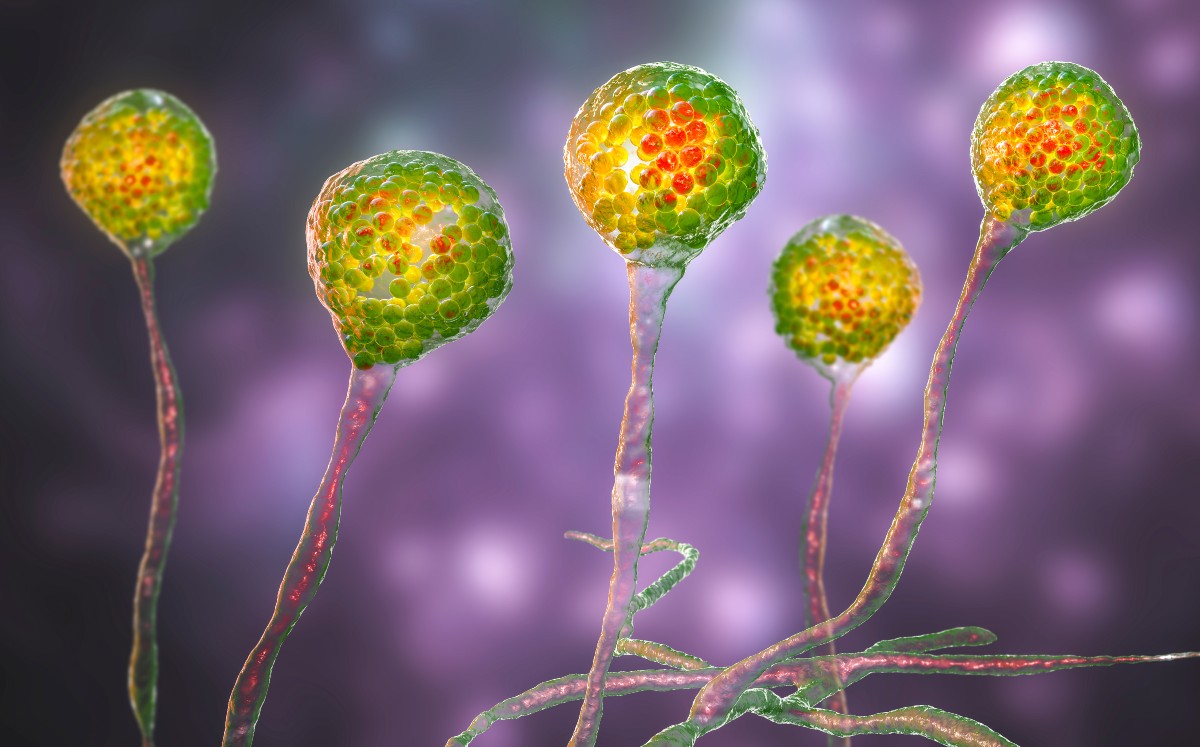 La mucormicosis, conocida como hongo negro es una infección micótica | Shutterstock
