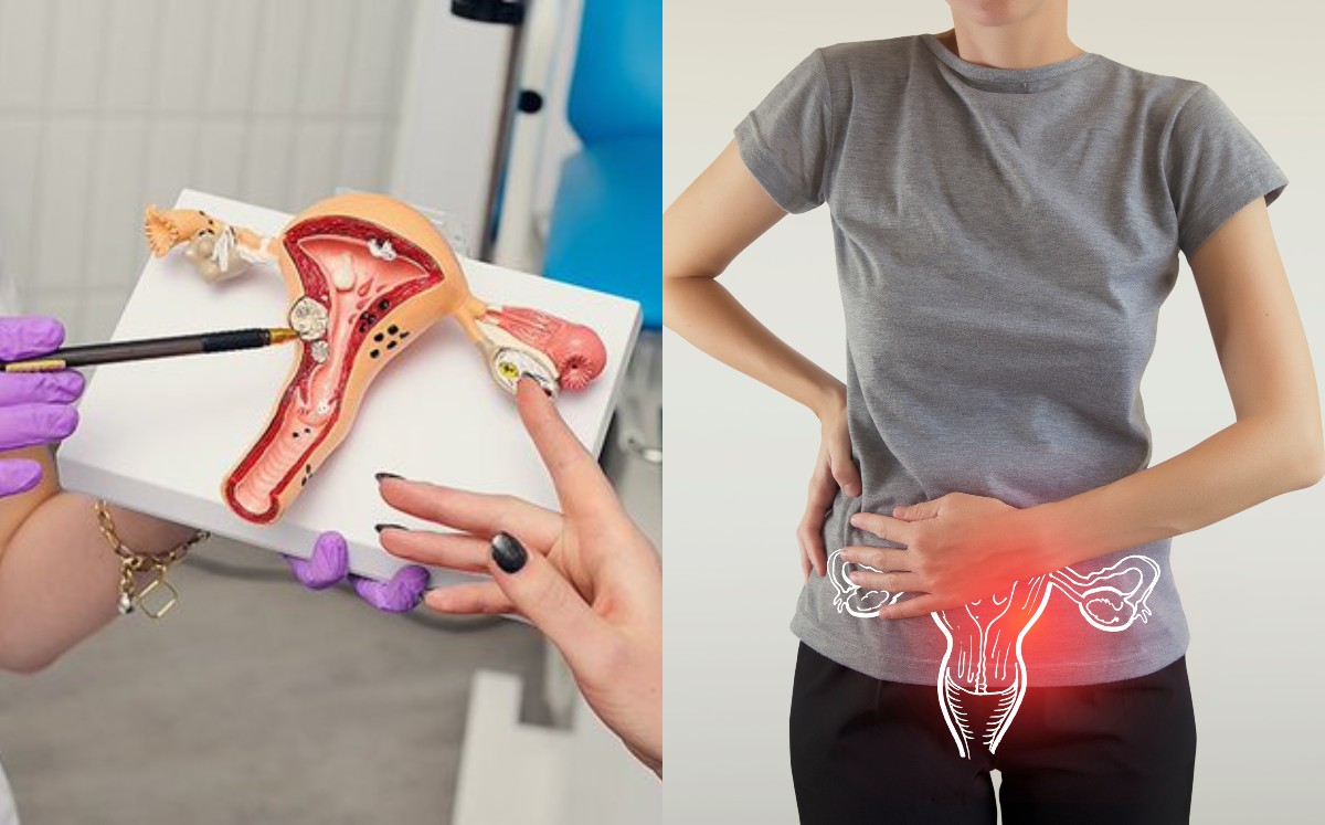 Este 9 de agosto se conmemora el Día Nacional de la Lucha contra el Cáncer Cervicouterino | Shutterstock