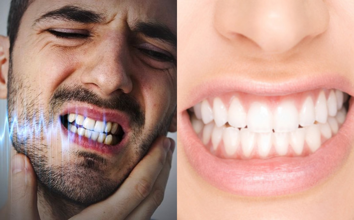 80 por ciento de mexicanos rechinan los dientes