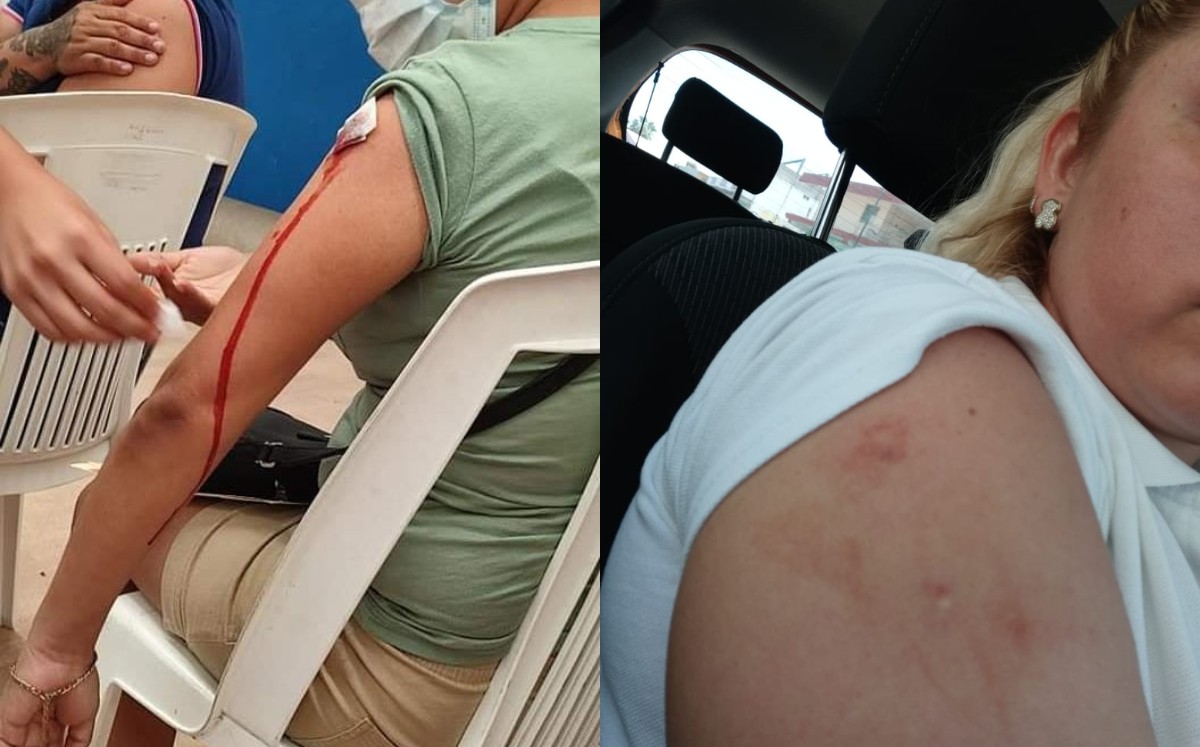 Denuncian mala aplicación de vacuna contra covid-19 en Tampico. (Redes Sociales)