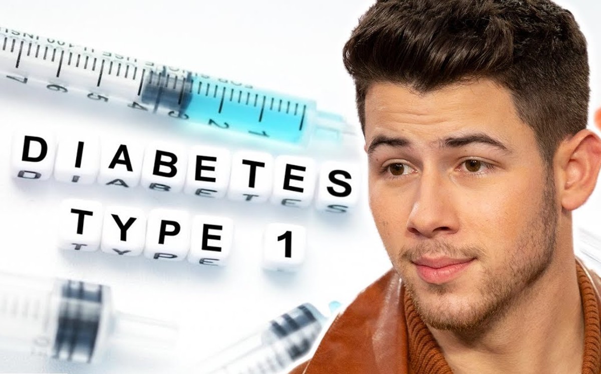 Nick Jonas y su vida con diabetes | Foto: News Feed