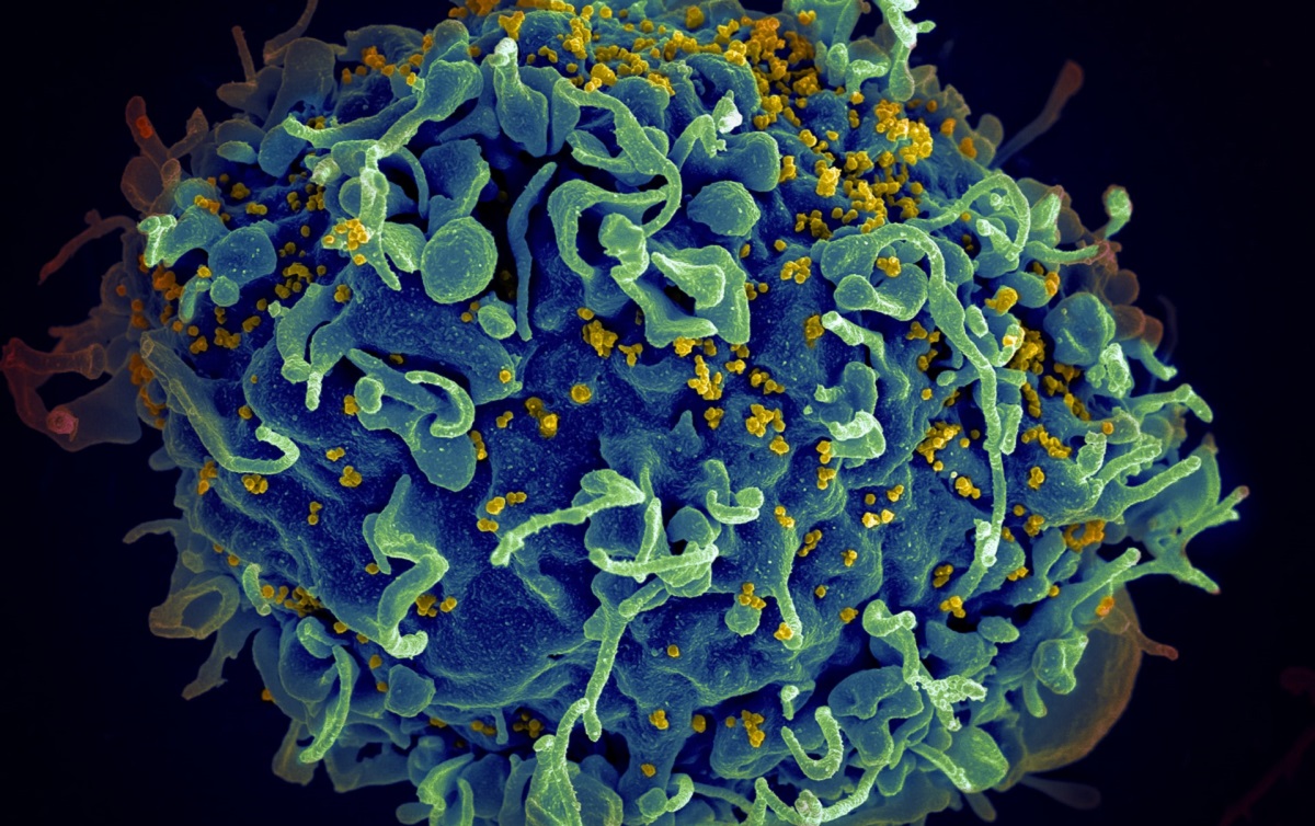 Virus de la Inmunodeficiencia Humana (VIH) infectando una célula humana. (Unsplash)