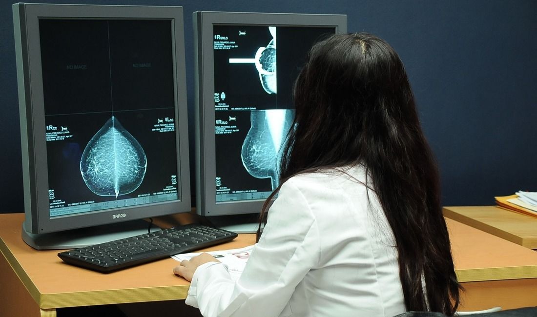 Cáncer de mama